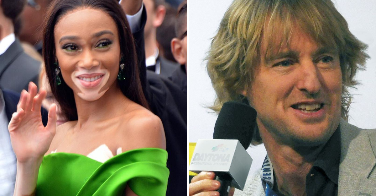 Famous People With Features That Set Them Apart