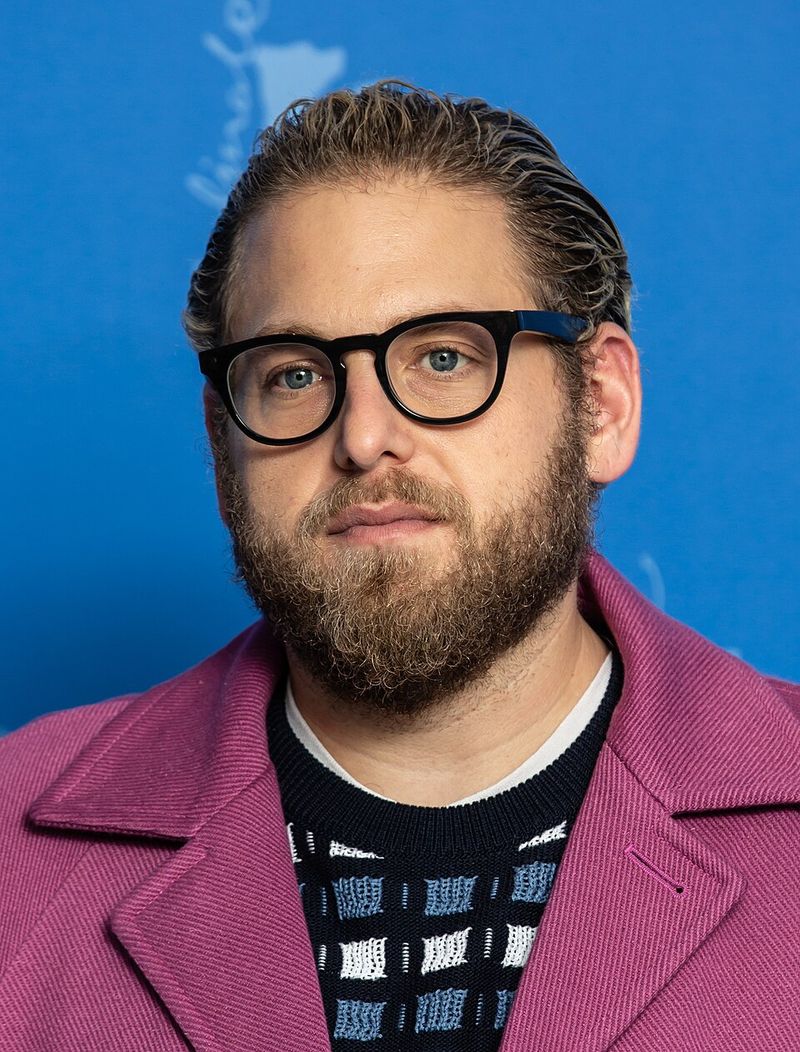 Jonah Hill's Arm Scar