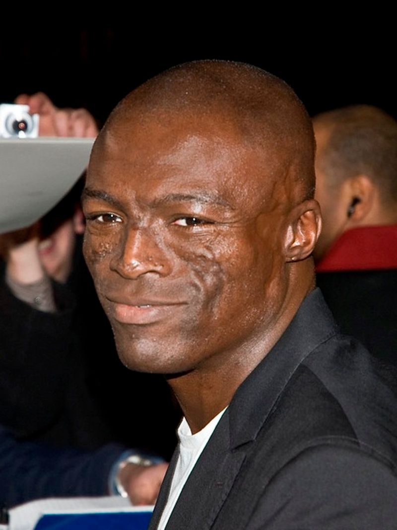 Seal's Wrist Scar