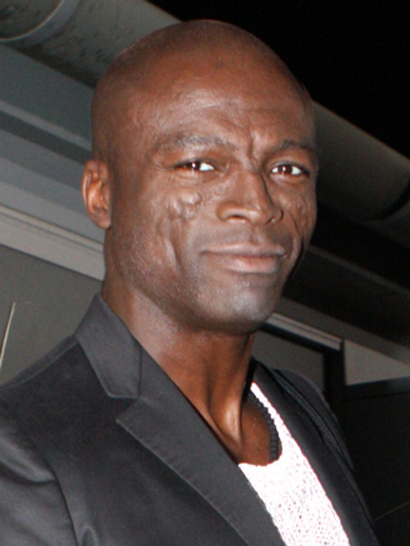 Seal's Facial Scars